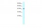 LHX3 antibody - middle region